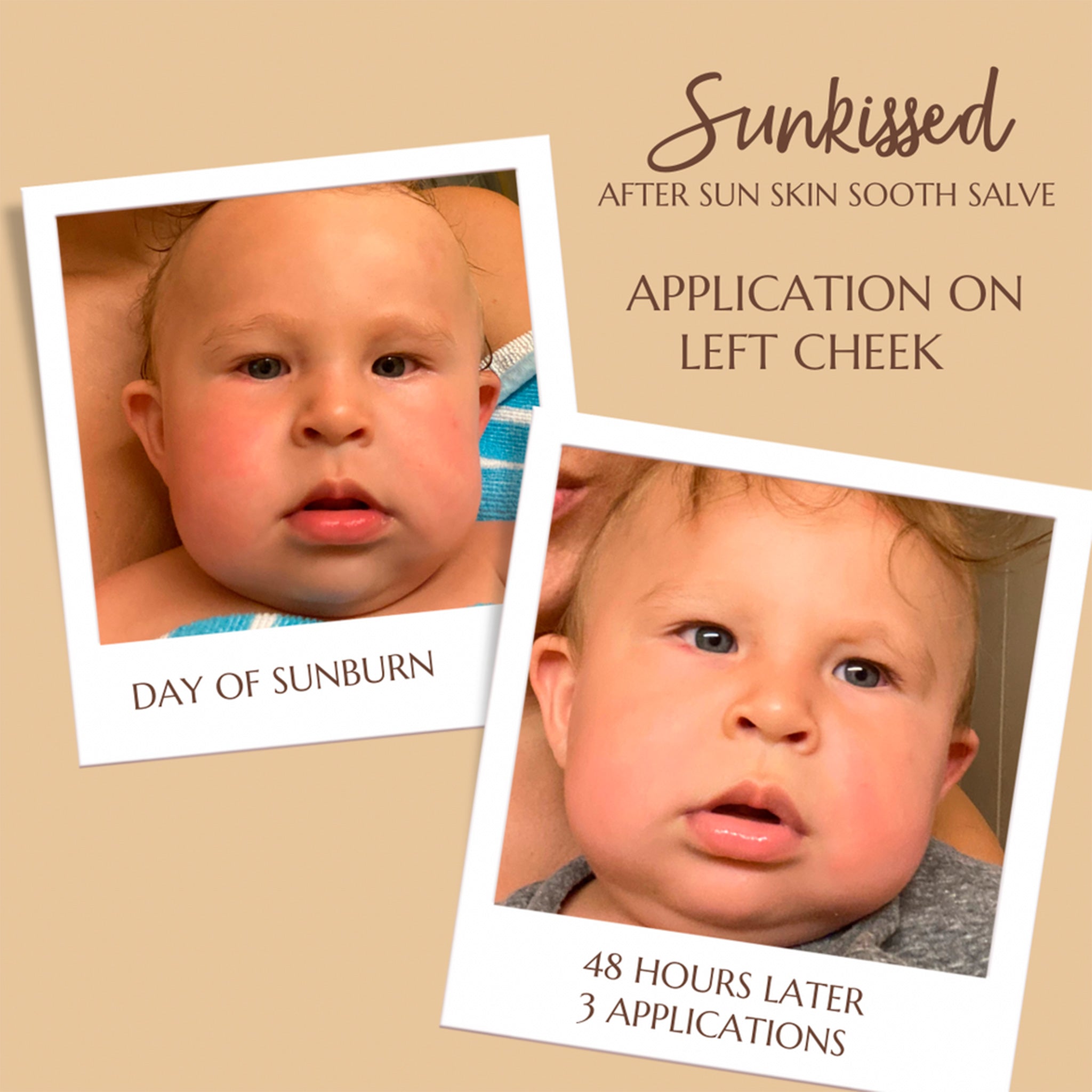 Sunkissed After Sun Soothing Skin Salve